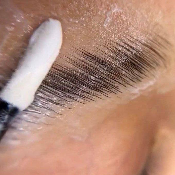 Brow Lifting